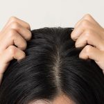 Cara Memilih Shampo Anti Ketombe dan Gatal yang Sesuai dengan Kebutuhan Kulit Kepala Anda